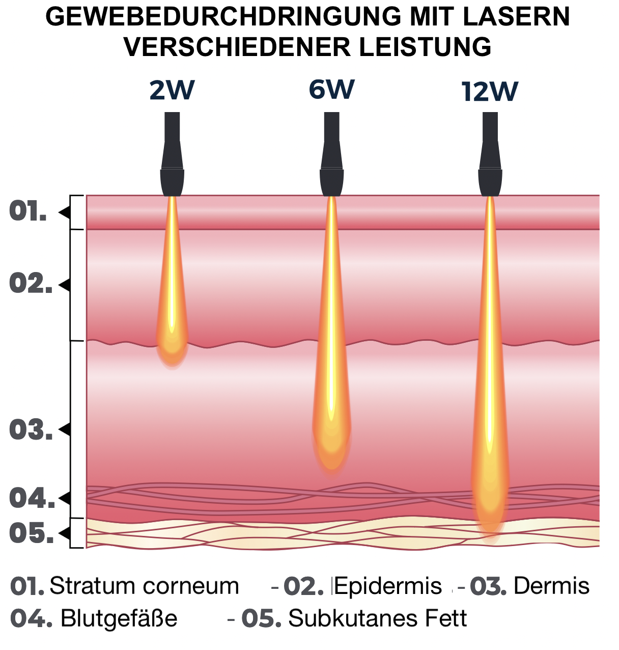 Gewebedurchdringung verschiedener Laserleistungen Vergleich